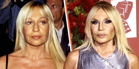 donatella versace age 20|Donatella Versace before plastic surgery.